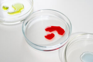 Est-il normal d’avoir peur du sang ?